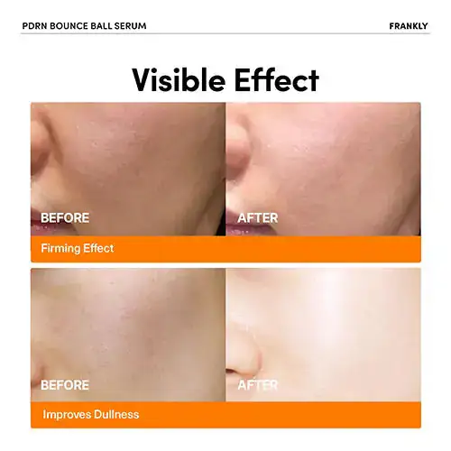Productafbeelding 4